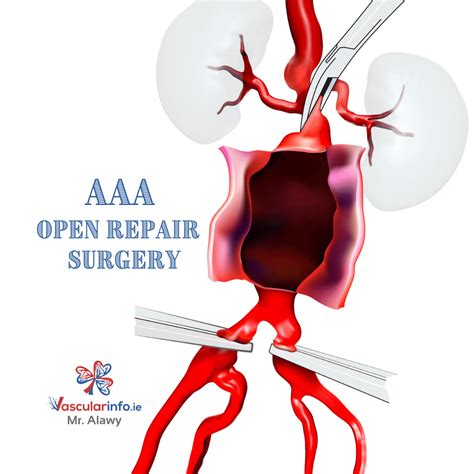 are aaa open